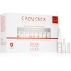 CADU-CREX Hair Loss HSSC Serious Hair Loss tratament de păr pentru femei împotriva căderii grave a părului pentru femei 20x3